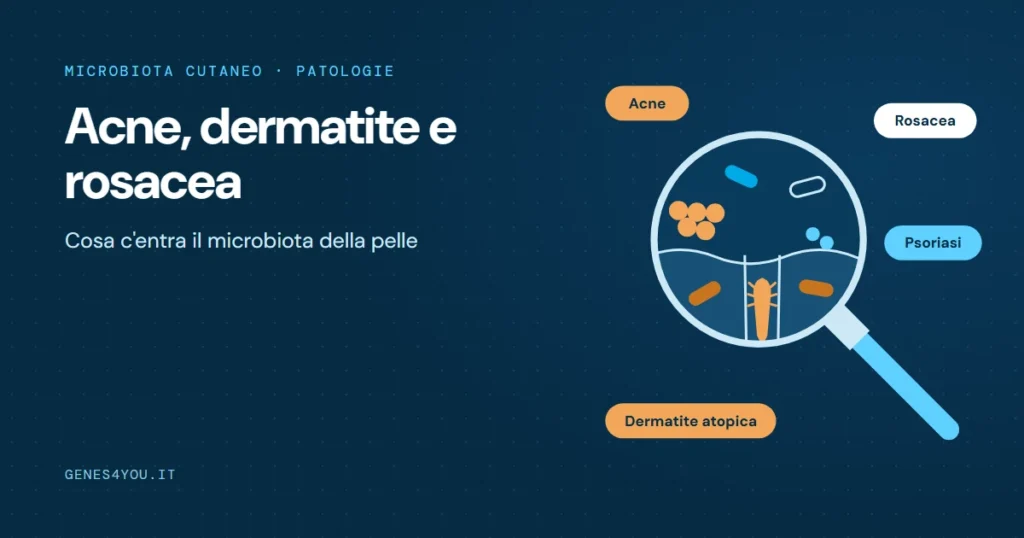 Acne e microbiota: lente d'ingrandimento sui batteri e sull'acaro Demodex della pelle, con acne, dermatite atopica, rosacea e psoriasi